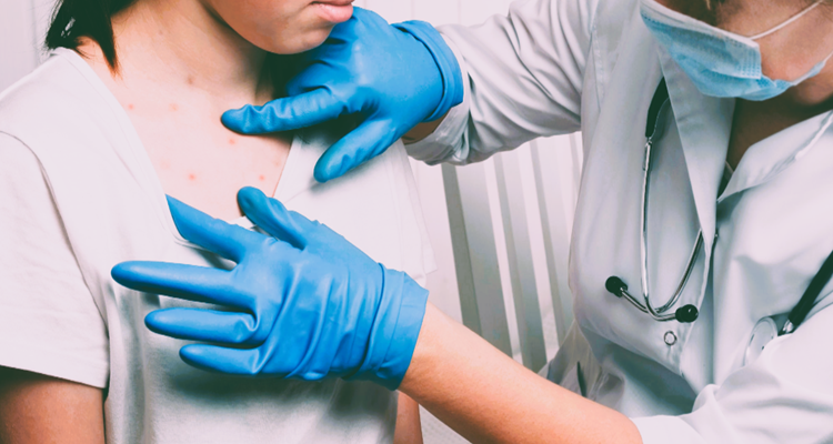 Measles Death in Texas Sparks Urgent Vaccination Debate Amid Growing Outbreak